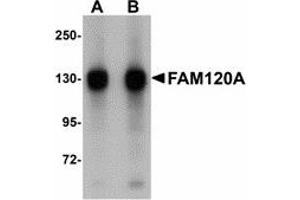 Image no. 1 for anti-Family with Sequence Similarity 120A (FAM120A) (Internal Region) antibody (ABIN478146) (FAM120A antibody  (Internal Region))