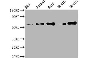Western Blot Positive WB detected in: 293 whole cell lysate, Jurkat whole cell lysate, Raji whole cell lysate, Mouse brain tissue, Rat brain tissue All lanes: PAK2 antibody at 1:2000 Secondary Goat polyclonal to rabbit IgG at 1/50000 dilution Predicted band size: 59 kDa Observed band size: 59 kDa (Recombinant PAK2 antibody)