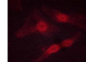 ABIN6267513 staining HeLa cells by ICC/IF. (STAT5 A/B antibody  (pSer725, pSer730))