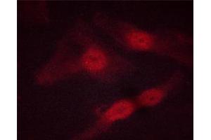 ABIN6267513 staining HeLa cells by ICC/IF. (STAT5 A/B antibody  (pSer725, pSer730))