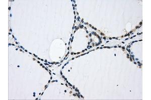 Immunohistochemical staining of paraffin-embedded pancreas tissue using anti-GBE1 mouse monoclonal antibody. (GBE1 antibody)
