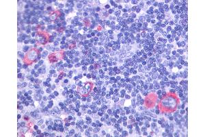 Anti-GPR137 antibody IHC of human Lymph Node, Hodgkins Lymphoma. (GPR137 antibody  (Extracellular Domain))