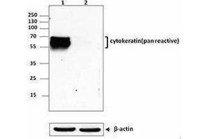 Western Blotting (WB) image for anti-Keratin 1 (KRT1) antibody (ABIN2664915) (Cytokeratin 1 antibody)