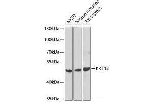 Western blot analysis of extracts of various cell lines using KRT13 Polyclonal Antibody at dilution of 1:1000. (Cytokeratin 13 antibody)