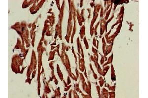 Immunohistochemistry of paraffin-embedded human heart tissue using ABIN7163262 at dilution of 1:100 (PHOSPHO1 antibody  (AA 1-267))