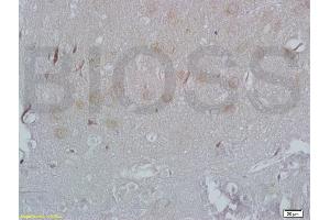 Immunohistochemistry (IHC) image for anti-Adrenergic, beta-3-, Receptor (ADRB3) (AA 310-408) antibody (ABIN737106)