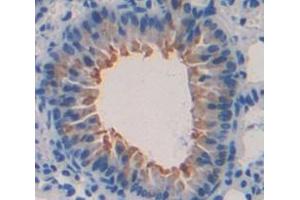 Used in DAB staining on fromalin fixed paraffin- embedded Kidney tissue (SLURP1 antibody  (AA 1-110))
