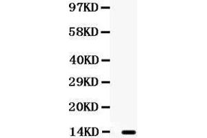Observed bind size: 13KD (S100A9 antibody  (AA 2-113))