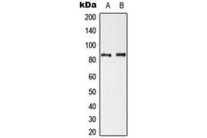 Western blot analysis of Cortactin (pY421) expression in HeLa UV-treated (A), NIH3T3 H2O2-treated (B) whole cell lysates.