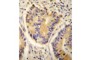 Immunohistochemistry (Paraffin-embedded Sections) (IHC (p)) image for anti-Alcohol Dehydrogenase 4 (Class II), pi Polypeptide (ADH4) (AA 319-348), (C-Term) antibody (ABIN654087)