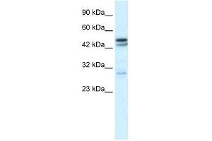 WB Suggested Anti-CHRNA3 Antibody Titration:  0. (CHRNA3 antibody  (N-Term))