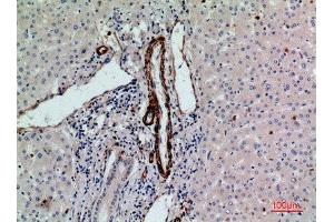 Immunohistochemistry (IHC) analysis of paraffin-embedded Human Liver, antibody was diluted at 1:100. (RHAG antibody  (N-Term))