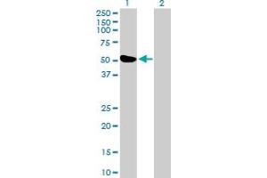 Western Blot analysis of ZBTB26 expression in transfected 293T cell line by ZBTB26 MaxPab polyclonal antibody. (ZBTB26 antibody  (AA 1-441))