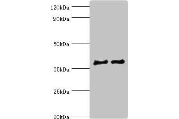 Cathepsin L2 antibody  (AA 105-334)