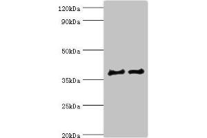 Western blot All lanes: CTSV antibody at 12 μg/mL Lane 1: Jurkat whole cell lysate Lane 2: MCF-7 whole cell lysate Secondary Goat polyclonal to rabbit IgG at 1/10000 dilution Predicted band size: 37 kDa Observed band size: 37 kDa (Cathepsin L2 antibody  (AA 105-334))