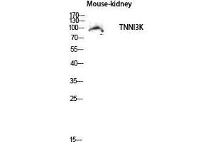 Western Blot (WB) analysis of Mouse Kidney lysis using TNNI3K antibody.
