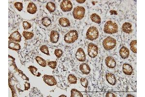 Immunostaining (ISt) image for anti-Claudin 1 (CLDN1) (AA 1-211) antibody (ABIN563931)