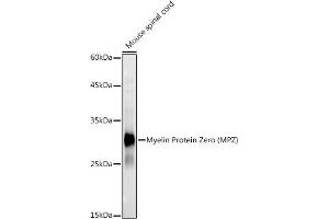 Western blot analysis of extracts of Mouse spinal cord, using Myelin Protein Zero (MPZ) antibody (ABIN3022393, ABIN3022394, ABIN1513218 and ABIN6218782) at 1:1000 dilution. (MPZ antibody)