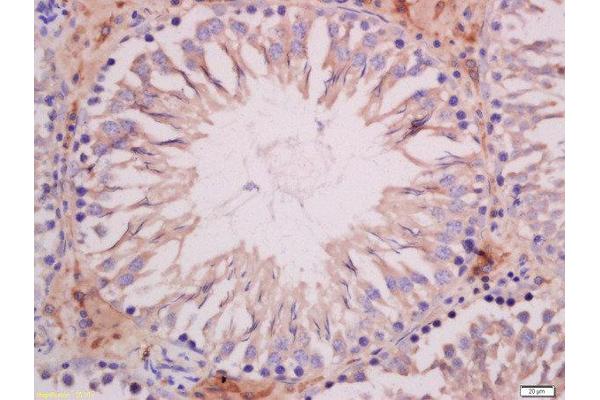 SOAT1 antibody  (AA 51-150)