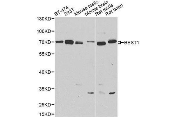 Bestrophin 1 antibody  (AA 200-300)