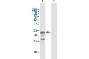 Western Blot analysis of KCNE1 expression in transfected 293T cell line by KCNE1 MaxPab polyclonal antibody.