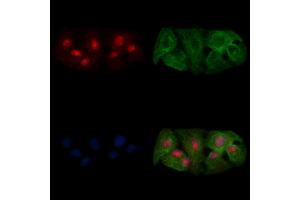 ABIN7094736 and ABIN7098787 staining  cells by IF/ICC. (OVOL2 antibody  (Internal Region))