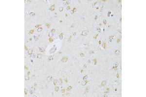 Immunohistochemistry of paraffin-embedded rat brain using NTS antibody (ABIN6290694) at dilution of 1:100 (40x lens). (Neurotensin antibody)