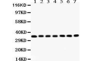 Anti- RACK1 antibody, Western blotting All lanes: Anti RACK1  at 0. (GNB2L1 antibody  (AA 2-317))