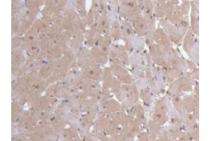 Detection of NIN in Rat Heart Tissue using Polyclonal Antibody to Ninein (NIN) (Ninein antibody  (AA 1-153))