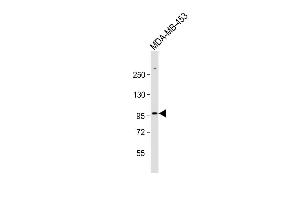 Anti-ZBTB49 Antibody (N-term) at 1:1000 dilution + MDA-MB-453 whole cell lysate Lysates/proteins at 20 μg per lane. (ZBTB49 antibody  (N-Term))