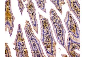 IHC analysis of CA2 using anti-CA2 antibody (ABIN6719533). (CA2 antibody  (AA 2-260))