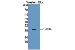 Detection of Recombinant Renalase, Human using Polyclonal Antibody to Renalase (RNLS) (RNLS antibody  (AA 160-319))