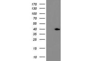 HEK293T cells were transfected with the pCMV6-ENTRY control (Left lane) or pCMV6-ENTRY ERCC1 (Right lane) cDNA for 48 hrs and lysed. (ERCC1 antibody)