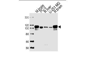 Lane 1: mouse brain lysates, Lane 2: PC-3 Cell lysates, Lane 3: rat liver Cell lysates, Lane 4: U-251 MG Cell lysates, Lane 5: rat brain Cell lysates, probed with USP5 (1340CT704. (USP5 antibody)