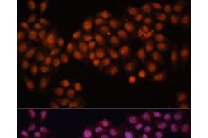 Immunofluorescence analysis of HeLa cells using CDC25A Polyclonal Antibody at dilution of 1:100 (40x lens). (CDC25A antibody)