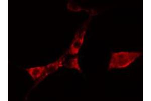 ABIN6274764 staining A549 cells by IF/ICC. (TROVE2 antibody  (N-Term))