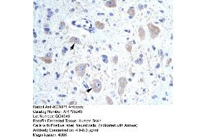 Human Brain (KCNIP1 antibody  (N-Term))