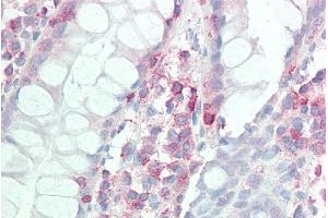 ABIN2613440 (5µg/ml) staining of paraffin embedded Human Colon. (IL17D antibody  (Internal Region))