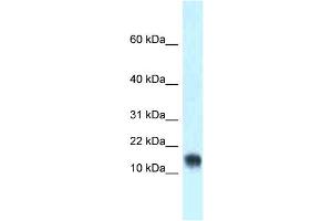 WB Suggested Anti-Lynx1 Antibody Titration: 1. (LYNX1 antibody  (Middle Region))