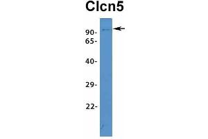 Chloride Channel 5 antibody  (Middle Region)