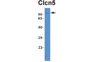 Host:  Rabbit  Target Name:  Clcn5  Sample Type:  Mouse Spleen  Antibody Dilution:  1. (Chloride Channel 5 antibody  (Middle Region))