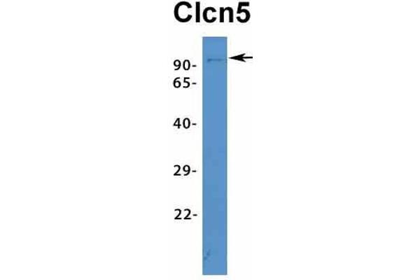 Chloride Channel 5 antibody  (Middle Region)