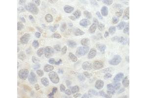 Immunohistochemistry (IHC) image for anti-SRSF Protein Kinase 1 (SRPK1) (AA 275-325) antibody (ABIN7448815)