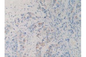 Figure. (SIRPA antibody  (AA 105-324))