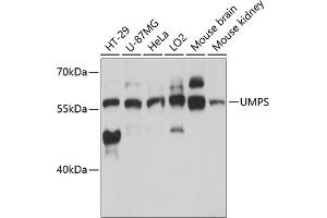 Western blot analysis of extracts of various cell lines, using UMPS antibody (ABIN6128901, ABIN6149927, ABIN6149929 and ABIN6217183) at 1:3000 dilution. (UMPS antibody  (AA 100-260))