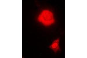 Immunofluorescent analysis of RBFOX3 staining in MCF7 cells. (NeuN antibody)