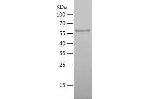 Western Blotting (WB) image for Melanoma Antigen Family A, 10 (MAGEA10) (AA 1-369) protein (His tag) (ABIN7123883) (MAGEA10 Protein (AA 1-369) (His tag))
