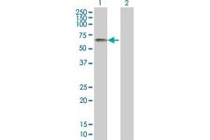 Western Blot analysis of XRCC4 expression in transfected 293T cell line by XRCC4 MaxPab polyclonal antibody. (XRCC4 antibody  (AA 1-336))