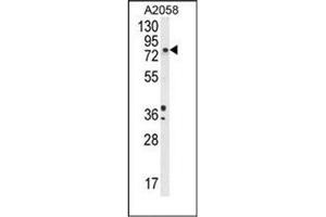 Western blot analysis of DBH Antibody (N-term) in A2058 cell line lysates (35ug/lane). (DBH antibody  (N-Term))