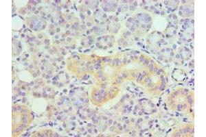 Immunohistochemistry of paraffin-embedded human pancreatic tissue using ABIN7173876 at dilution of 1:100 (TNFRSF21 antibody  (AA 371-655))